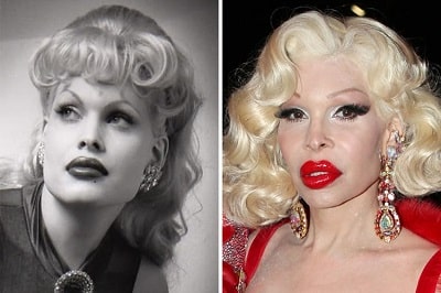 A picture of Amanda Lepore before (left) and after (right).